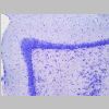 Neuronas Nissl 20.jpg